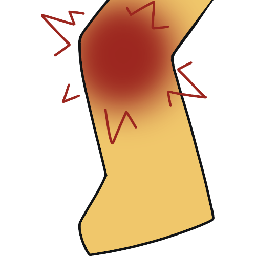a simple emoji yellow leg and foot, with the knee red and sharp pain lines around it.